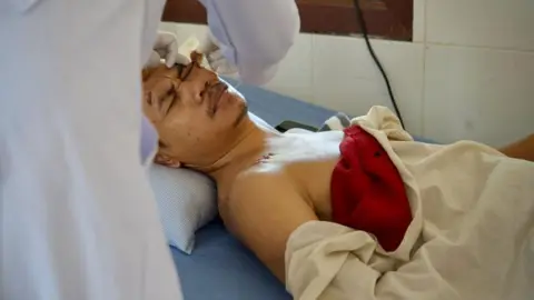 BBC A doctor pulls a bandage off the wounded head of a Cambodian soldier at a hospital in southern Cambodia