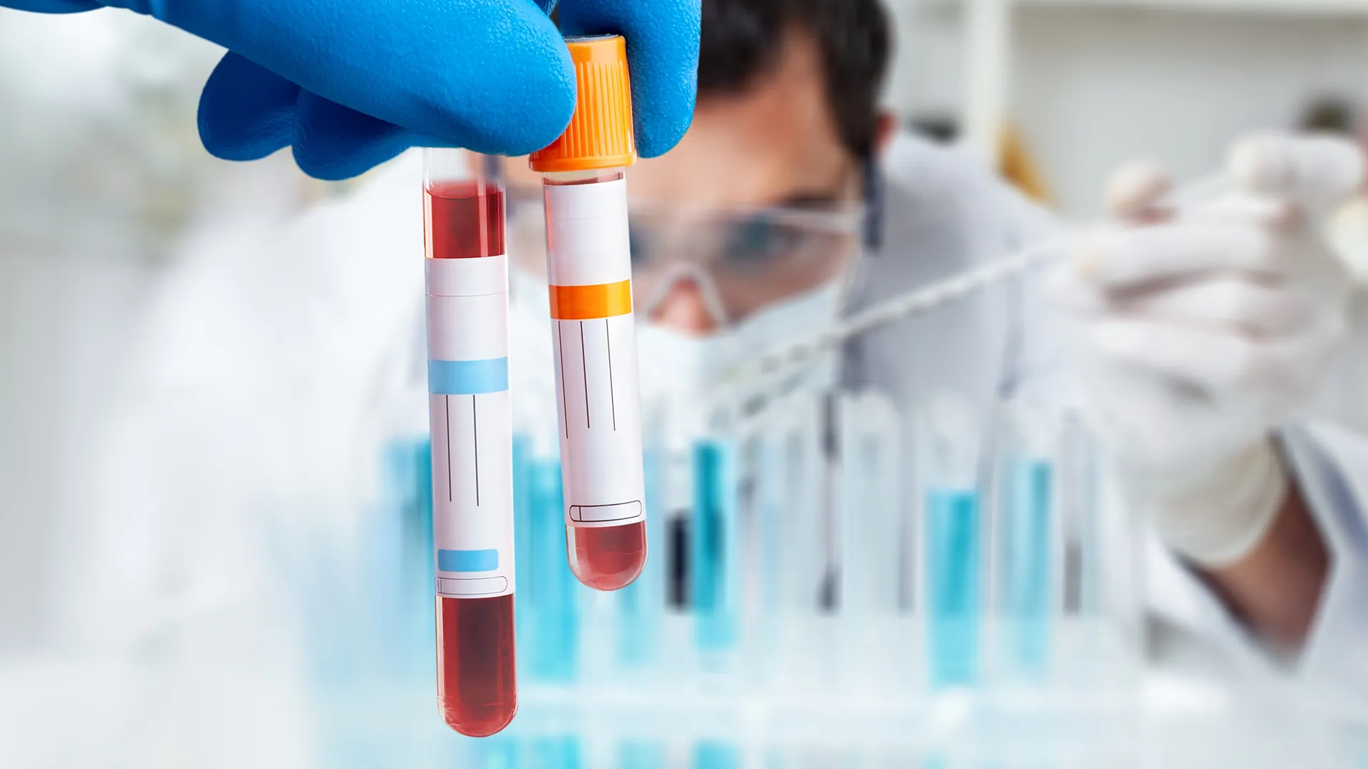 The common blood test that predicts how fast Alzheimer’s hits