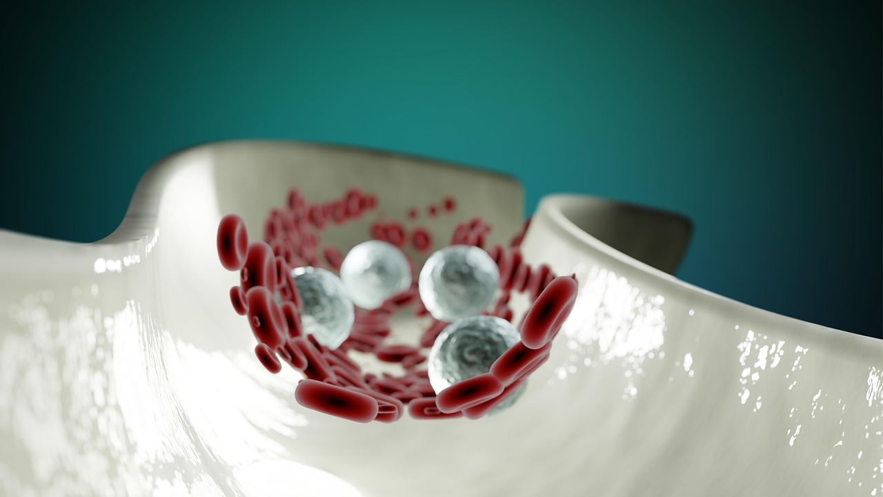 Immune Cells Found to Drive Complex Symptoms of Systemic Sclerosis