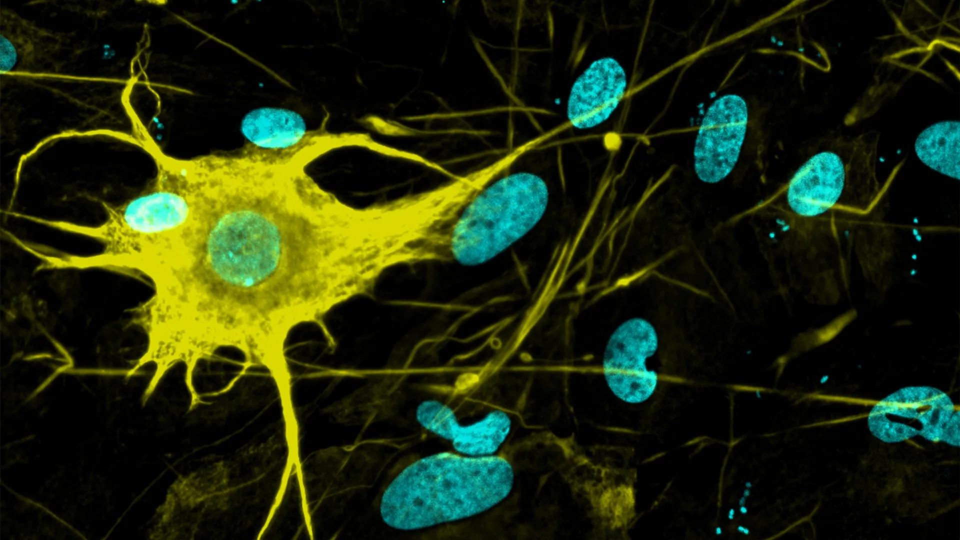 Researchers grow 400+ brain cell types—a leap for Alzheimer’s and Parkinson’s research