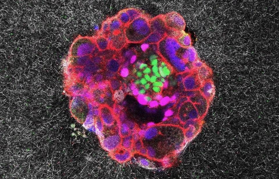 Dramatic Footage Captures Human Embryo Implanting In Real Time