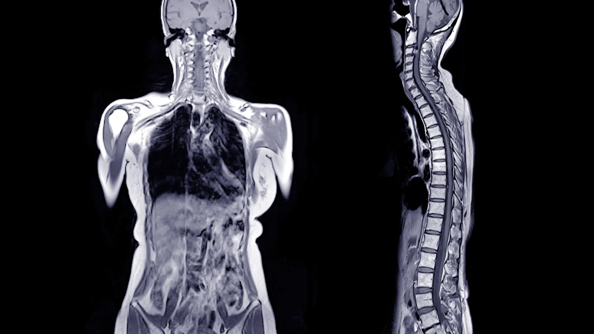 He ate a hamburger and died hours later. Doctors found a shocking cause