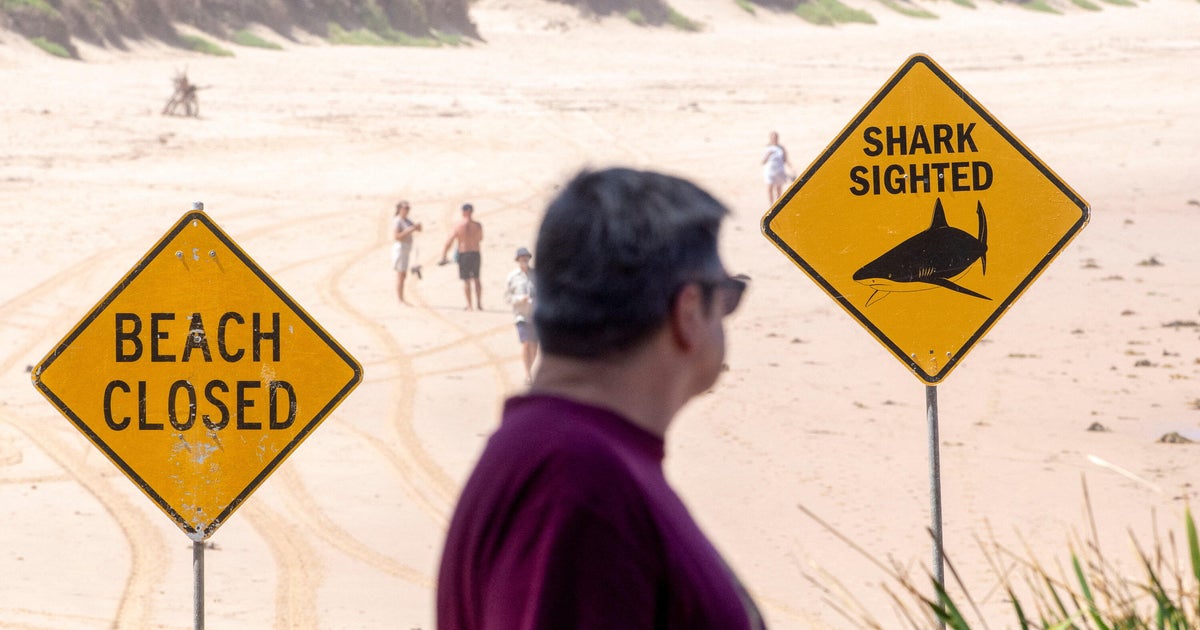 Australian boy dies days after being bitten by shark in Sydney Harbor
