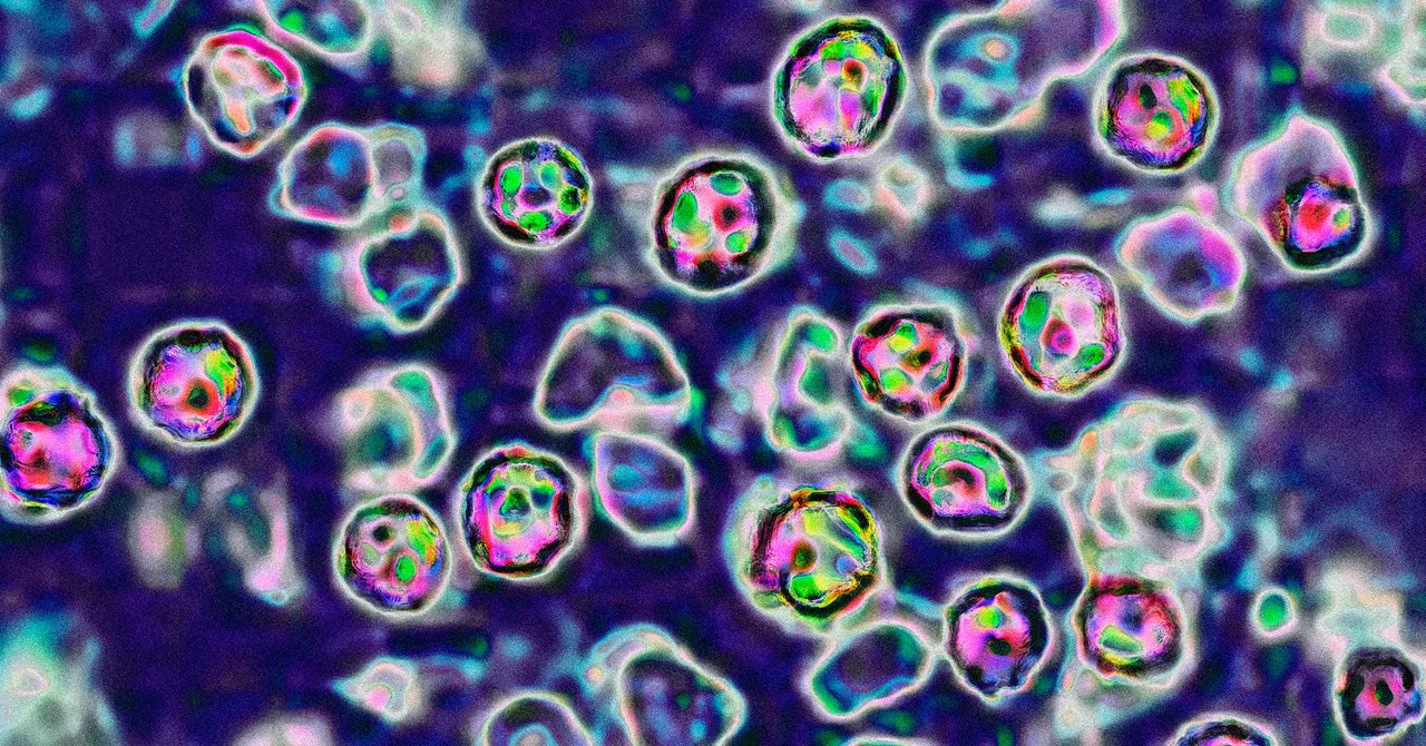 The US Is In For Another Bad Year of Measles Cases