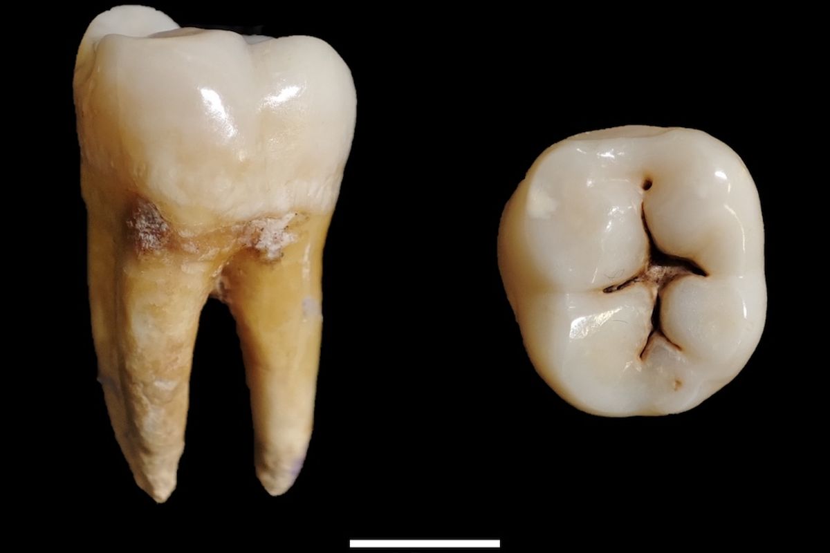 2,500-Year-Old Iron Age Teeth Reveal How Ancient Childhoods and Diets Unfolded