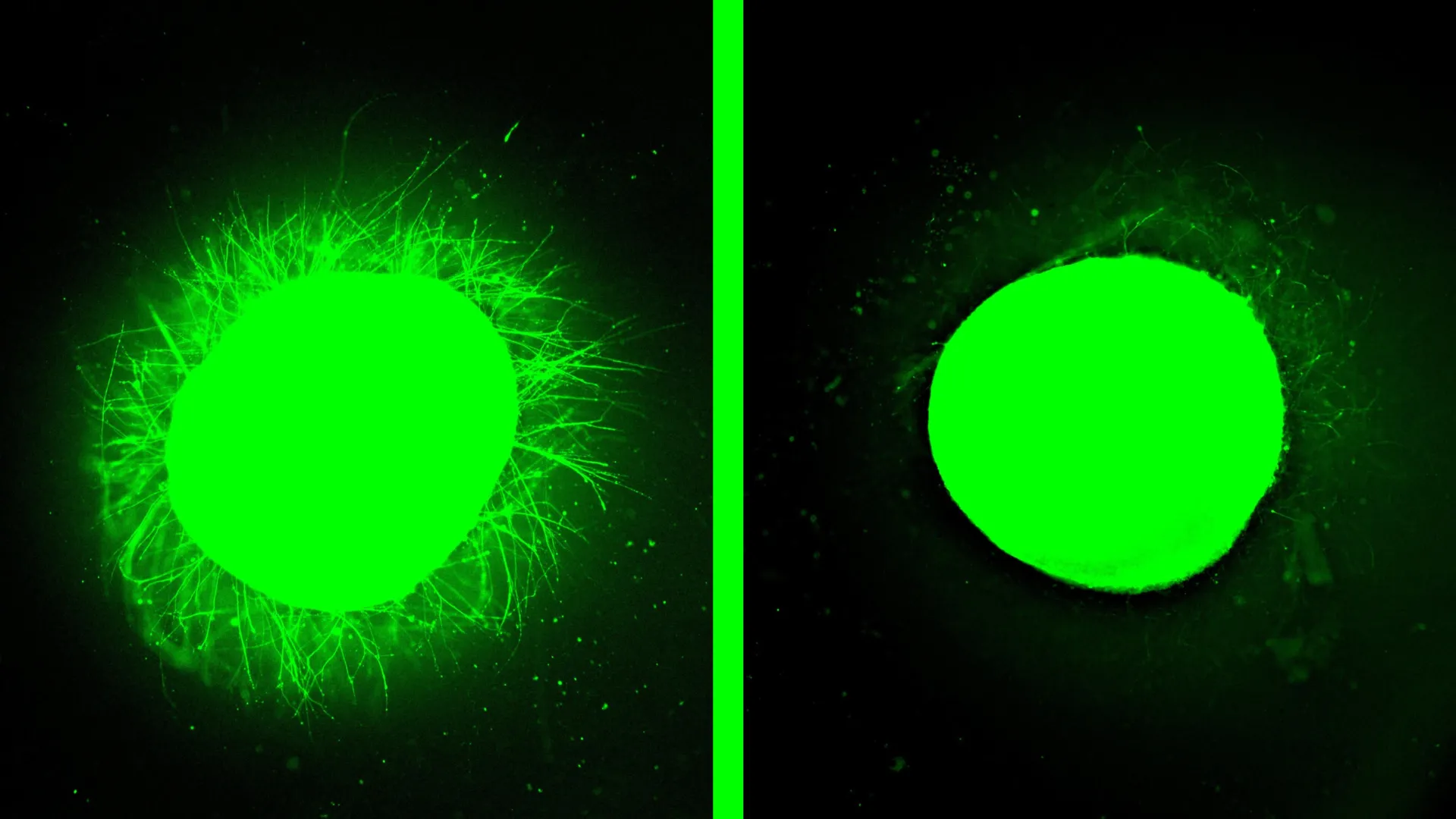Lab grown human spinal cord heals after injury in major breakthrough