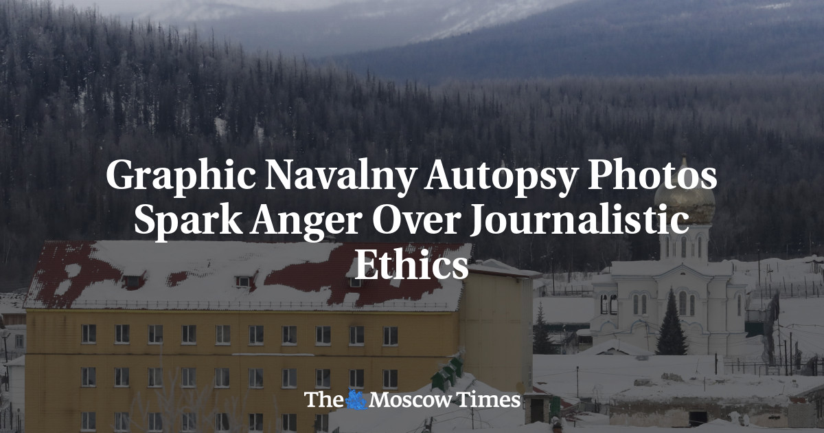 Graphic Navalny Autopsy Photos Spark Anger Over Journalistic Ethics