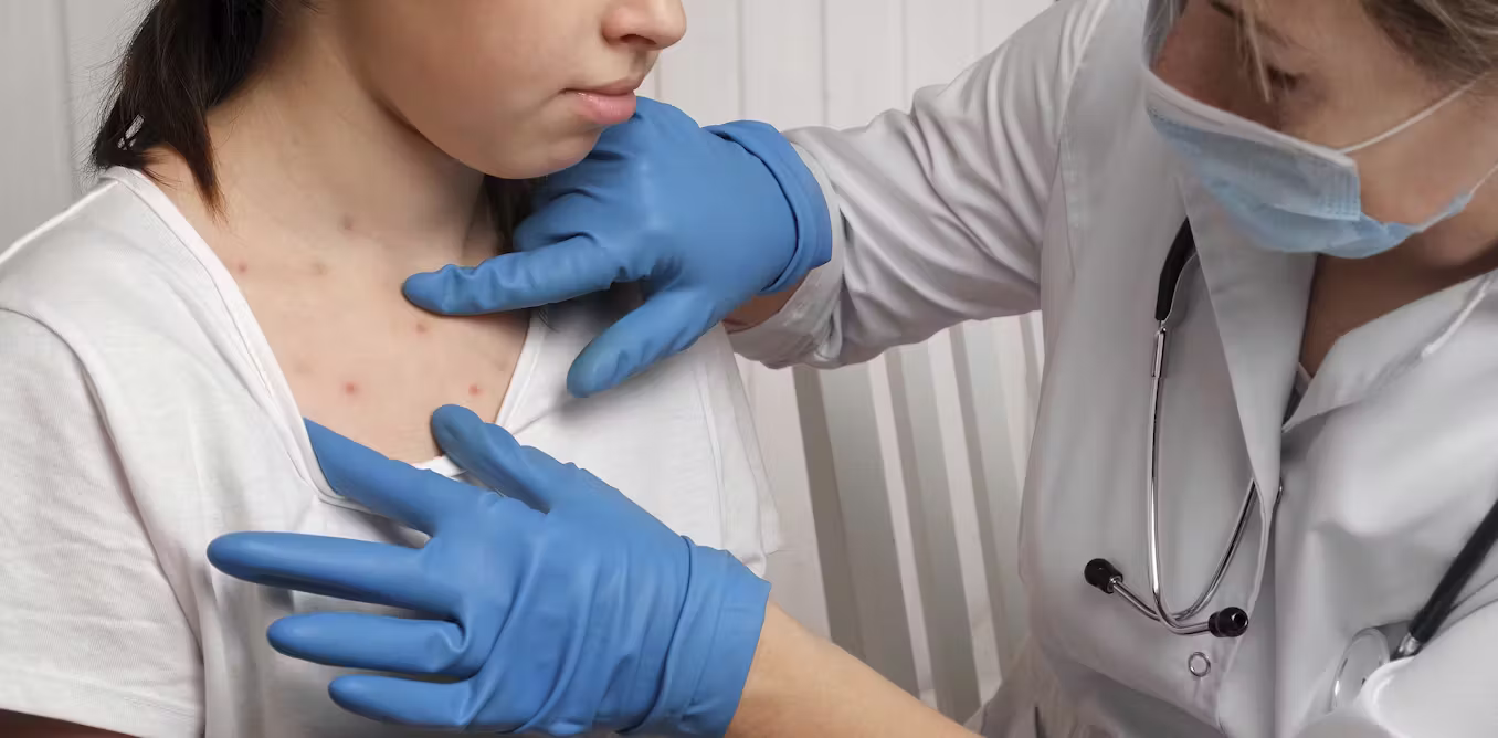 We study pandemics, and the resurgence of measles is a grim sign of what’s coming