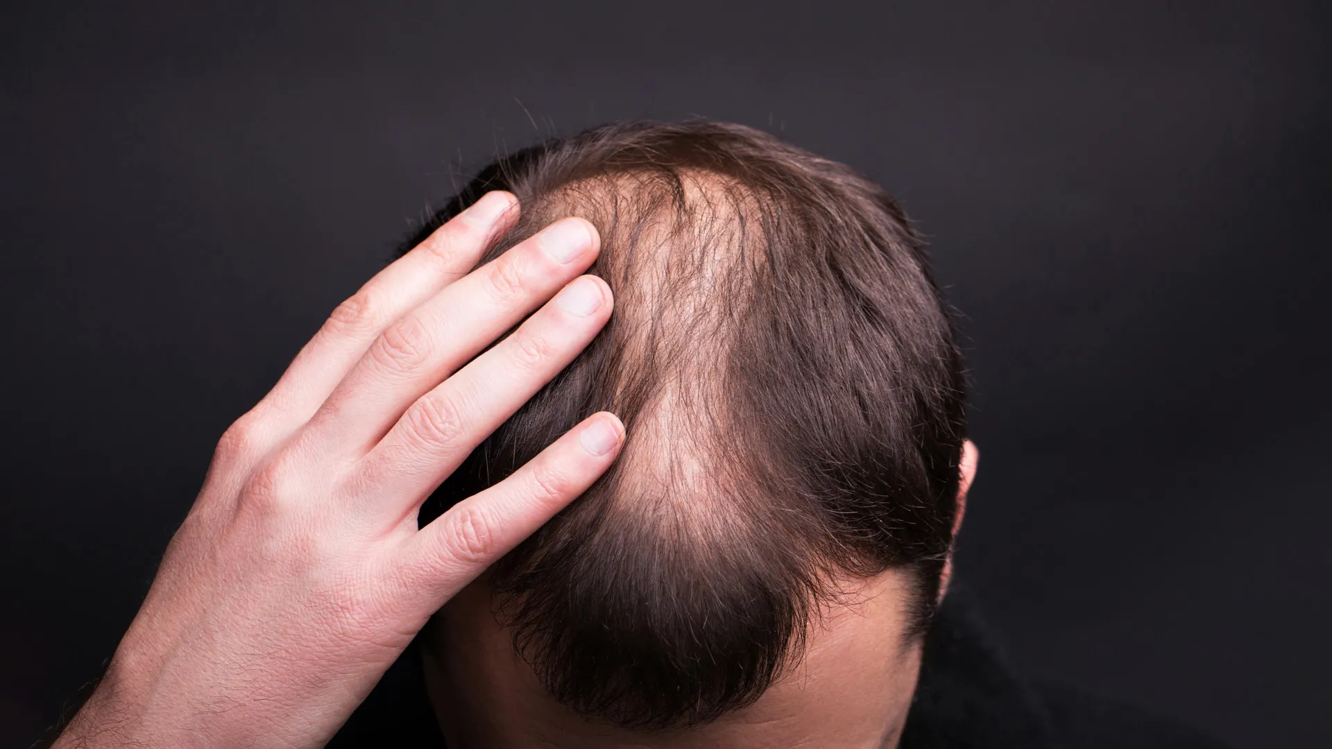 Textbooks were wrong: Scientists reveal the surprising way human hair really grows